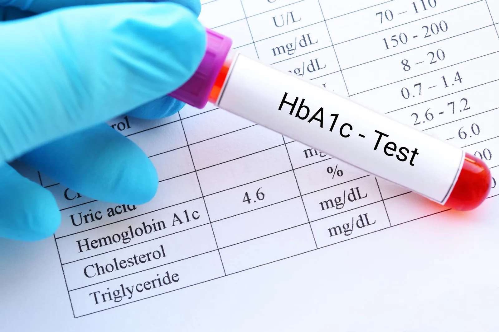 Laboratory technician analyzing blood samples